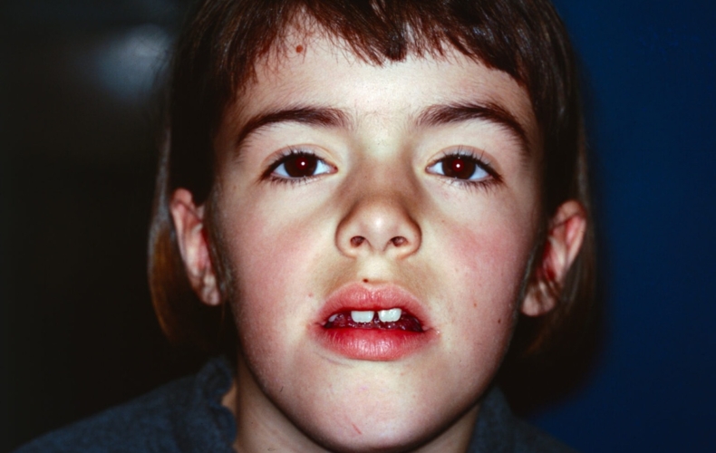 Julie Botet Lymph Blood Story 9424 © David Le Borgne