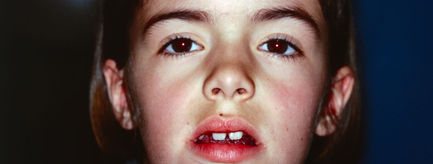 Julie Botet Lymph Blood Story 9424 © David Le Borgne